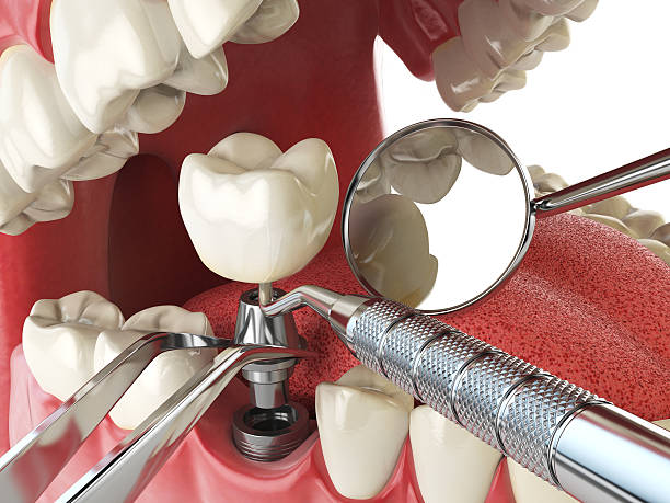 Best Emergency Gum Pain Relief  in Fallbrook, CA